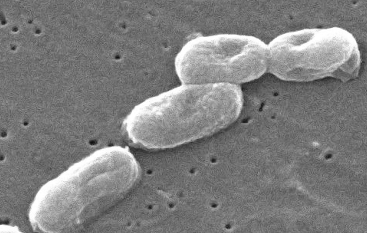 Burkholderiaceae - MRGI - Microbiota Research Group of Iran