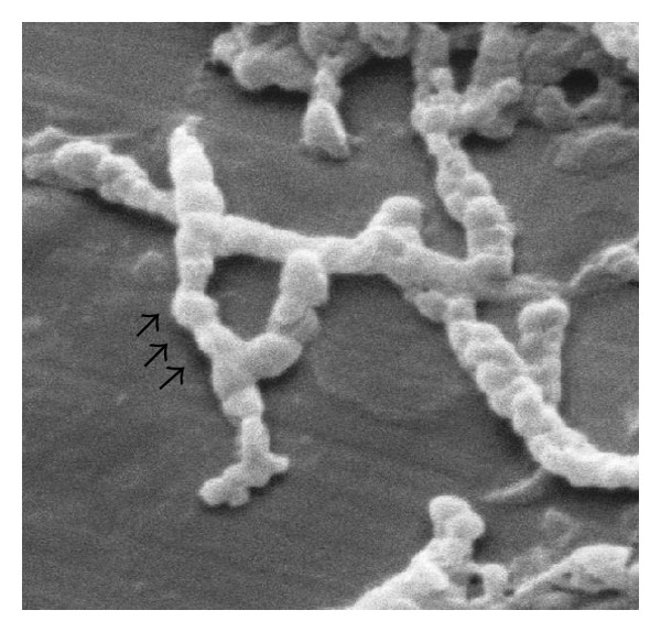 Comamonas MRGI Microbiota Research Group of Iran