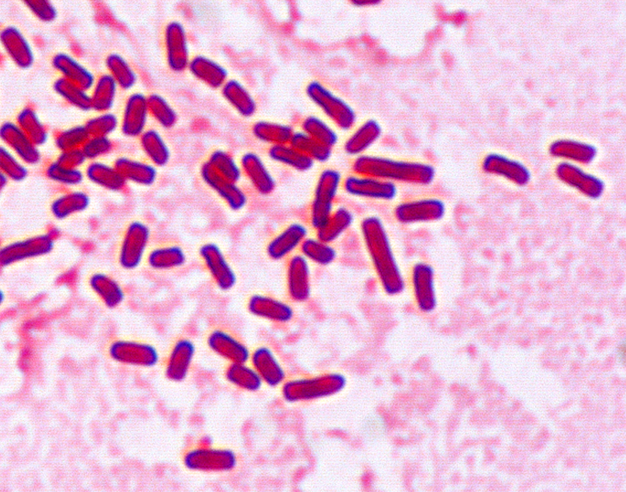 Az enterobacteriaceae spp kenetek férfiakban