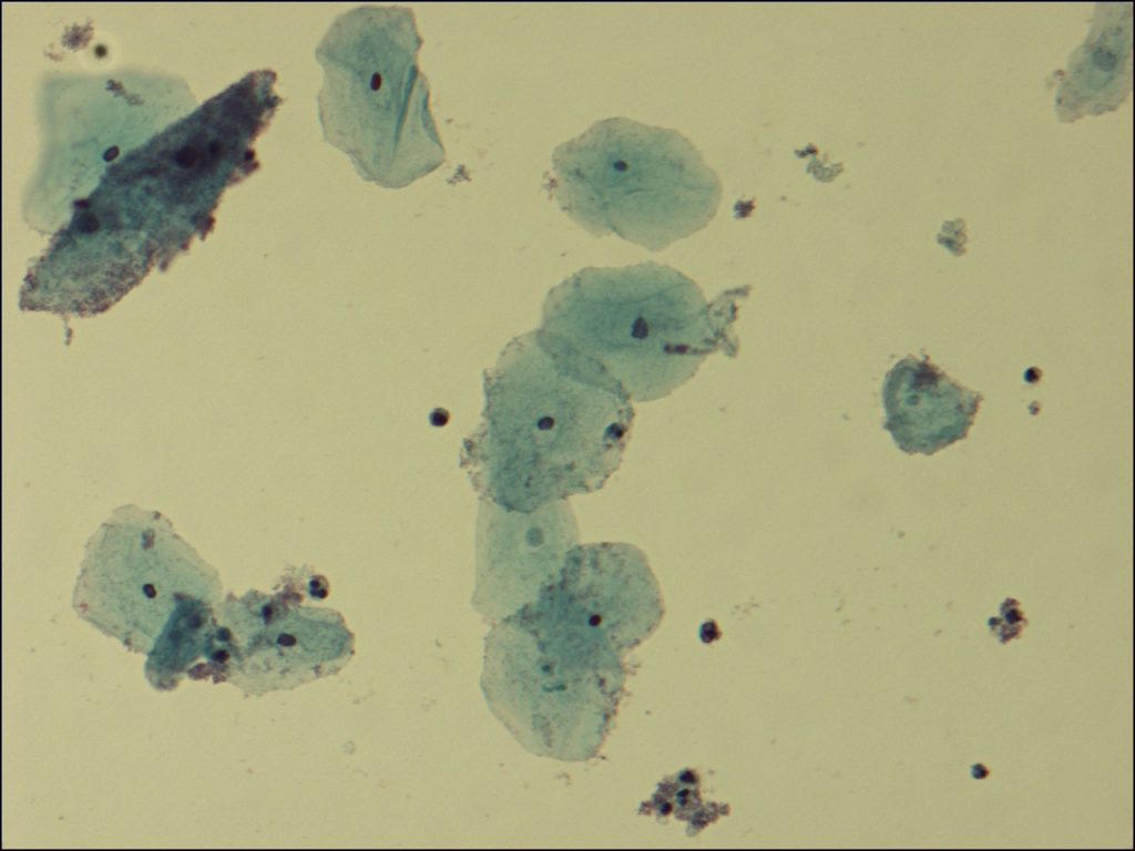 Gardnerella - MRGI - Microbiota Research Group of Iran