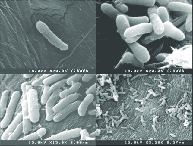 Serratia MRGI Microbiota Research Group of Iran