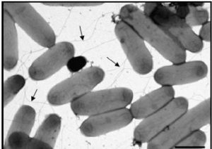 Acidovorax MRGI Microbiota Research Group of Iran